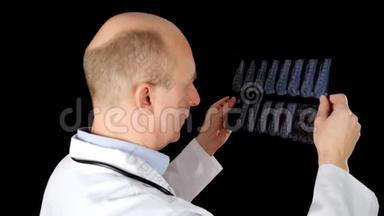 黑色背景下分离的脊椎x光片。穿医用长袍的外科医生在x光片上检查脊椎骨